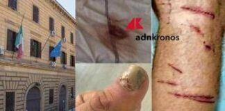 Denunciò botte e sequestro in cella nel carcere di Regina Coeli: “Ora vivo nella paura, colpisce il silenzio delle istituzioni”