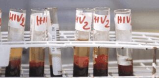 Hiv, oggi a Bari incontro su terapie long acting e prevenzione