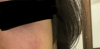 Vicenza, agenti della Polizia Locale aggrediti: Rucco (FdI) e DICCAP-SULPM chiedono più sicurezza e… taser Polizia locale di Vicenza, la ferita di uno dei due agenti aggrediti