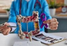 Tumori del colon retto, Int Milano in progetto Ue che punta a prevedere efficacia immunoterapia