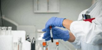 Alzheimer, test del sangue possono prevedere l’inizio dei sintomi