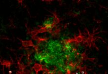 Alzheimer: una “molecola smart” del Cnr promette di rivoluzionare la terapia