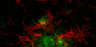 Alzheimer: una “molecola smart” del Cnr promette di rivoluzionare la terapia