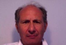 ‘Faccia a luna piena’ e pelle sottile, è la sindrome di Cushing. Cos’è e come si cura