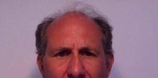 ‘Faccia a luna piena’ e pelle sottile, è la sindrome di Cushing. Cos’è e come si cura