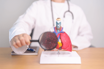 Fibrosi cistica, in Gazzetta ufficiale ok di Aifa a rimborsabilità per tripla combinazione