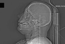 L’inchiesta horror sulle violenze iraniane: ‘Manifestanti uccisi e colpiti nelle parti vitali’