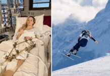 Lindsey Vonn, terzo intervento dopo l’infortunio: “Sto facendo progressi”