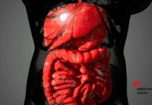 Malattia di Crohn, solo 1 paziente su 3 riceve supporto nutrizionale