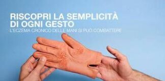 Mani che bruciano e fanno male, al via campagna su eczema cronico