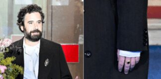 Sanremo, Tommaso Paradiso con la mano fasciata: “Ho fatto un disastro…”