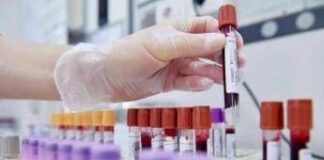 Allarme oncologi: “- 50% trial in Europa in 10 anni mentre Cina accelera”