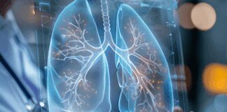 Cancro aggressivo al polmone, con mix di farmaci biologici raddoppia efficacia senza chemio