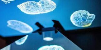 Ictus, ecco come l’emisfero sano del cervello influenza la ripresa: la ricerca rivoluzionaria