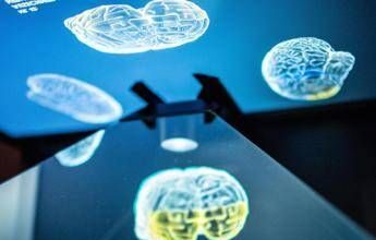 Ictus, ecco come l’emisfero sano del cervello influenza la ripresa: la ricerca rivoluzionaria