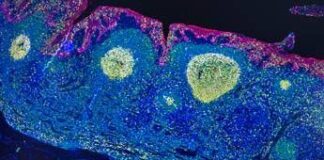 Irccs Pascale Napoli, ‘mappa Gps’ delle cellule rivoluziona l’immunoterapia