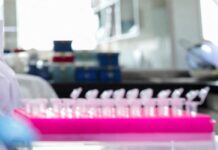 Milano, focolaio di tubercolosi all’Istituto di Medicina legale: 8 casi conclamati e 7 positivi. Indagini sull’origine del contagio