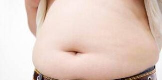 Obesità, allarme ictus anche nei giovani: peso in eccesso moltiplica il rischio