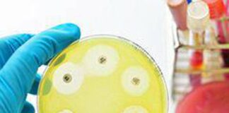 Ai e medicina di precisione per combattere super batteri resistenti, lo studio italiano su quasi 10.000 pazienti