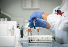 Alzheimer, nuovo test del sangue potrebbe prevedere sintomi imminenti