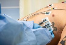 Caldo, disidratazione e sbalzi pressori: ecco le 10 regole per proteggere la salute del cuore