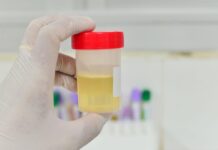 Dai segnali del colore alla postura, sui social è ‘urina mania’ tra scienza e falsi miti