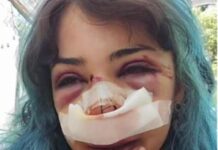Bari, studentessa picchiata al parco: indagati per lesioni e rapina custode bagni e il compagno