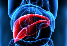 Mash, esperti a confronto su importanza diagnosi per patologia epatica sottovalutata