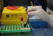 Sanità, nuovo tariffario, Medicina di laboratorio: “Oltre 70% scelte cliniche dipende da analisi”