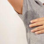 Svelato l’interruttore genetico che fa sudare troppo, nuove speranze per l’iperidrosi