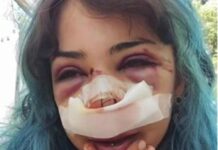 Bari, studentessa picchiata nei bagni denuncia nuovo episodio: “Mi hanno accerchiata”