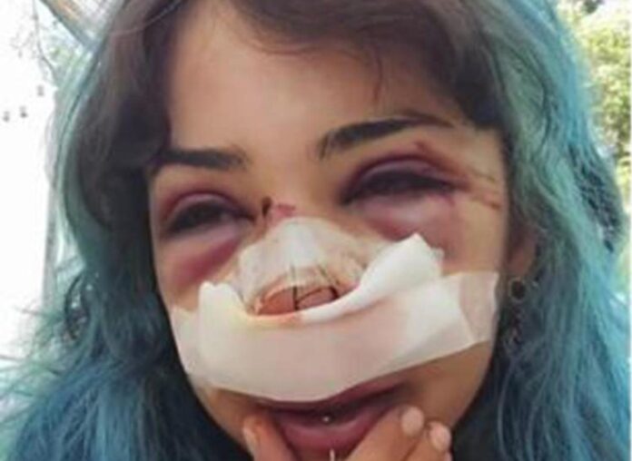 Bari, studentessa picchiata nei bagni denuncia nuovo episodio: “Mi hanno accerchiata”