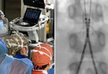 Incidente con un’acquasantiera in chiesa, bimba di 6 anni operata d’urgenza all’aorta a Bari