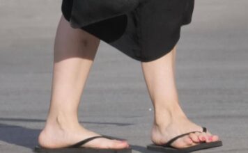 Infradito fanno bene o male ai piedi? Il parere del medico: “Ecco chi non deve usarle”