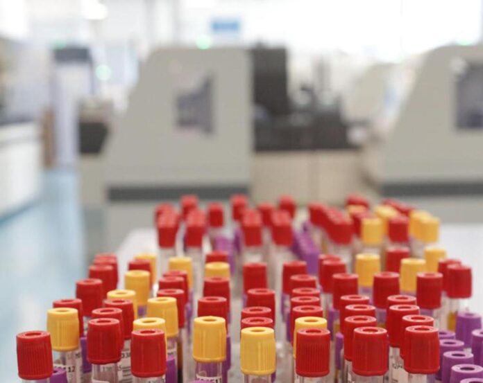 Malaria in aeroporto in Germania, gli esperti: “Campanello d’allarme, ma il rischio resta contenuto”
