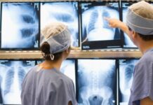 Pillole di informazione alle ore 21: radiologia negli ospedali vicentini e controlli presso 11 strutture. E più medici per medicina generale Radiologia negli ospedali vicentini