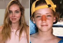 Chiara Ferragni, l’intervento al naso: “Ecco perché è storto ora”