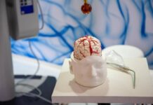 Dai gliomi al Parkinson, così l’intelligenza artificiale aiuta la Neurochirurgia