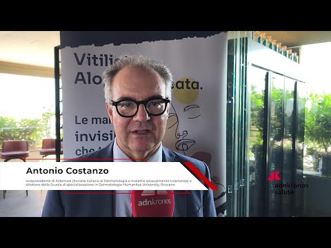 Farmaci: Costanzo (Sidemast), ‘attendiamo ok Aifa per nuova cura per vitiligine e alopecia’