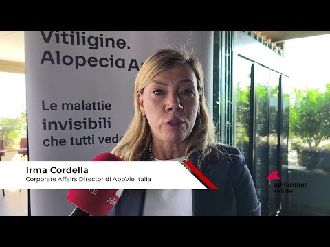 Farmaci: vitiligine e alopecia, Cordella (AbbVie) ‘impegnati a migliorare standard di cura anche