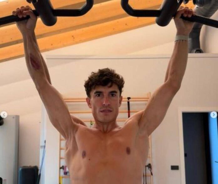 Marquez e la foto choc: il pilota mostra la spalla ‘deformata’