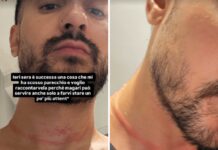 Mr. Daniel, il make-up artist dei vip, aggredito e rapinato a Milano: il racconto choc sui social