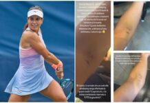 US Open, Stefanini e il livido sul braccio: “Colpa di un controllo antidoping…”