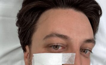 Veneto, il presidente Alberto Stefani ferito in un incidente stradale: stava andando al consiglio federale della Lega a Milano