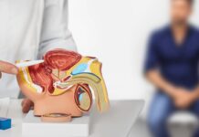 Cancro alla prostata, apalutamide con terapia ormonale riduce del 62% rischio di recidiva o morte