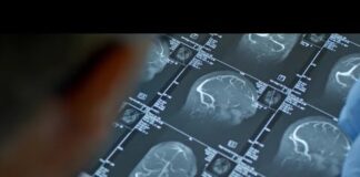 Fenilchetonuria, ‘screening neonatale evita danni neurologici ma serve continuità assistenziale’