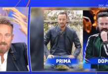 Francesco Facchinetti, la battaglia contro la calvizie: “Ho trovato la pace con una patch cutanea”