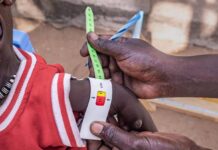 Save the Children: 1 bambino su 4 sotto i 5 anni, nel mondo, soffre di grave povertà alimentare